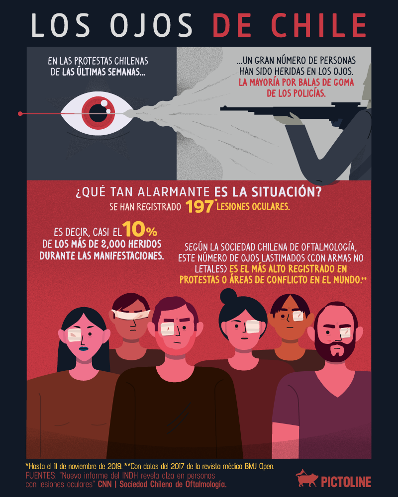 Los ojos de Chile: Durante las protestas ha destacado el gran número de heridas oculares por balas de goma, una cantidad nunca antes registrada en el mundo