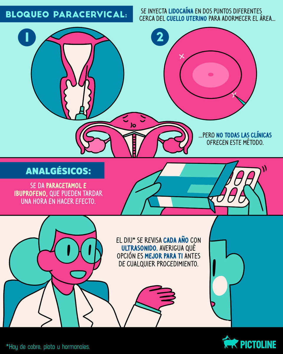 ¿Qué método anticonceptivo prefieres? ✍️⁣ ⁣ #Anticonceptivos #DIU #Prevención